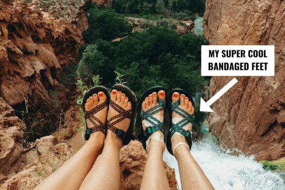 Feet dangling over a waterfall wearing Chacos sandals with bandages.
